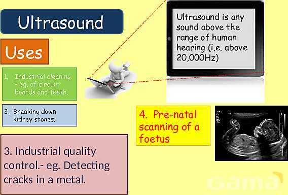 The Science of Sound: Waves, Speed, Echoes & Ultrasound Applications Explained- پیش نمایش